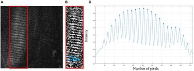 Variability of in vivo Sarcomere Length Measures in the Upper Limb Obtained With Second Harmonic Generation Microendoscopy